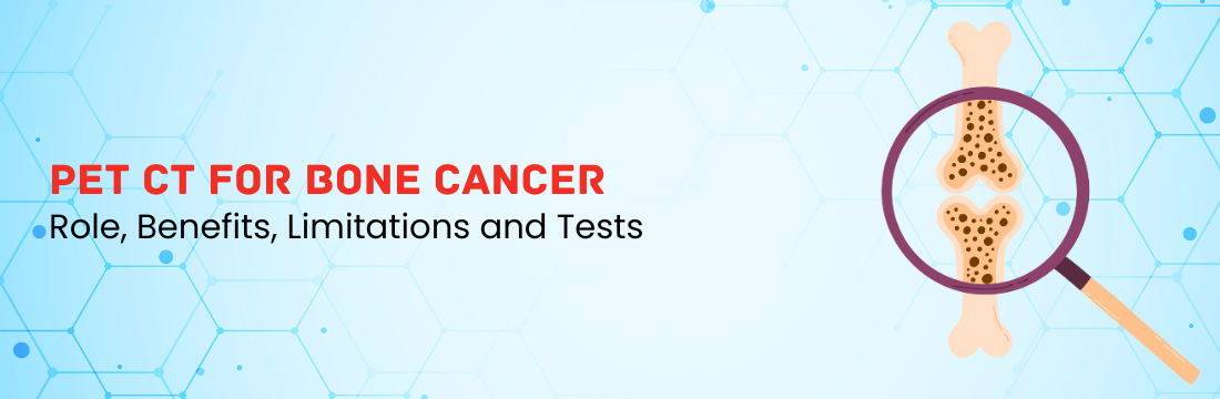 PET CT for Bone Cancer: A Complete Guide